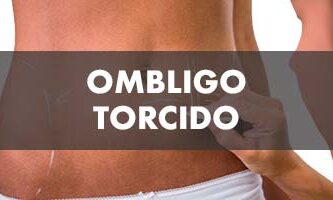 Ombligo Torcido Después de una Abdominoplastia - John Garcia Cirugía Plástica