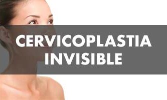 Cervicoplastia Invisible - John Garcia Cirugía Plástica