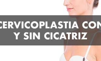 Diferencias entre Cervicoplastia con y sin Cicatriz - John Garcia Cirugía Plástica